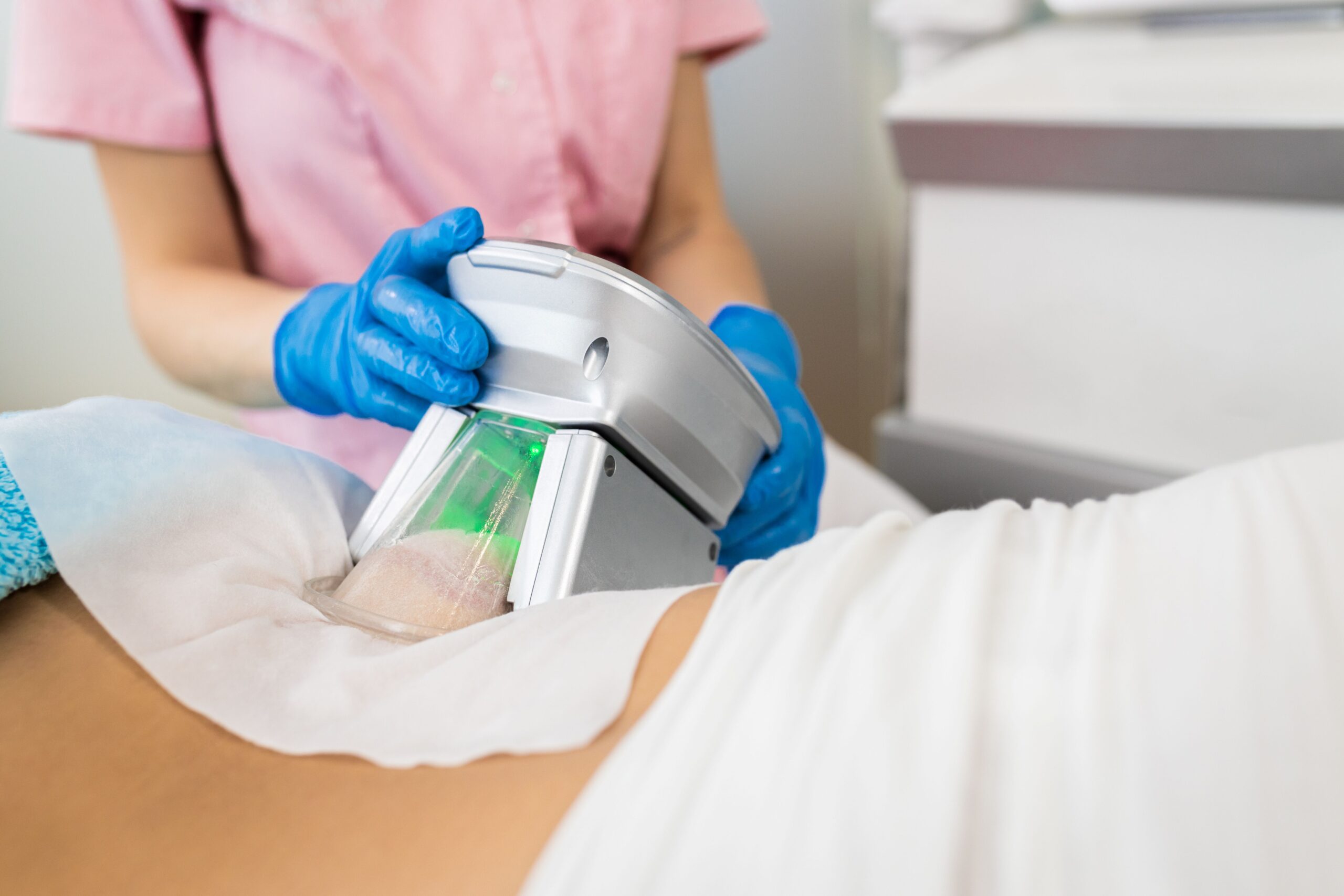 Kryolipolyse Behandlung_Behandlung